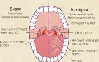 Почему болит горло, и чем его лечить при беременности?