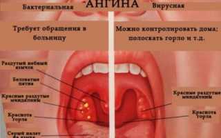 Через сколько дней проходит ангина у детей при приеме антибиотиков