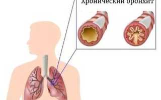 Сколько длится температура и кашель после пневмонии у ребенка? Почему не проходят?