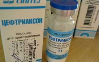 Как правильно и сколько дней колоть при гайморите уколы Цефтриаксон
