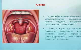 Заразна ли ангина как передаётся продолжительность инкубационного периода