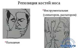 Узнаем как вызвать кровь из носа. Провоцирующие факторы