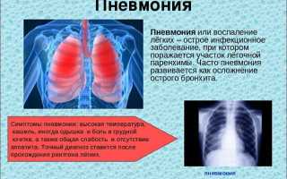 Почему появляется кашель при насморке? Как и чем лечить недуг?