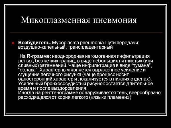 Атипичная микоплазменная пневмония