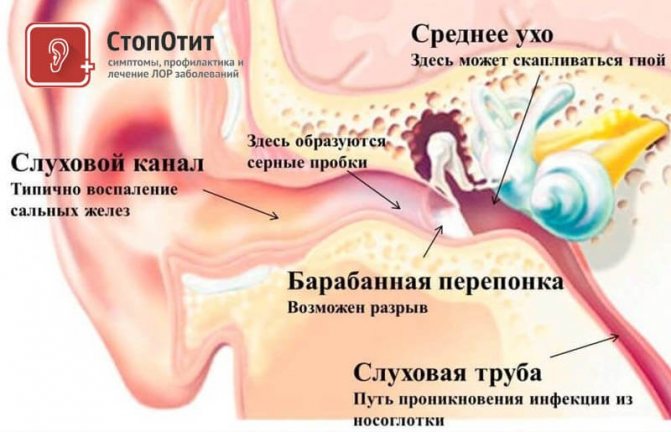 Барабанная перепонка