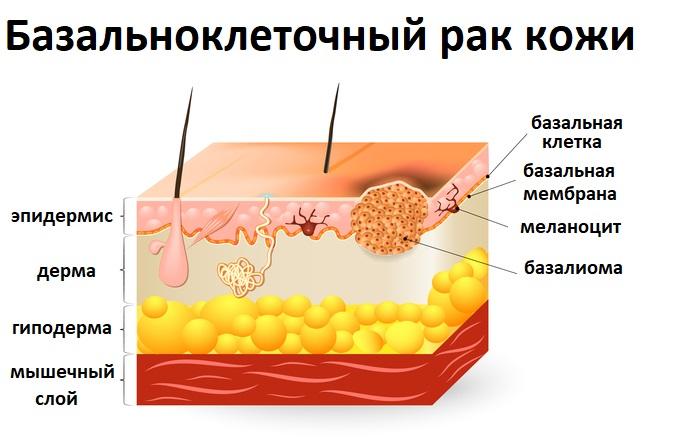 вид
